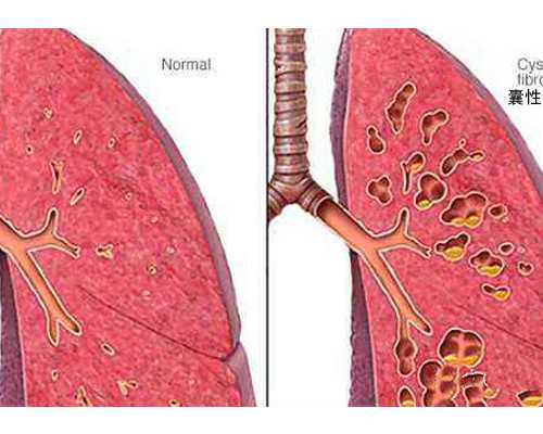 正规助孕机构解析试管费用与成功率
