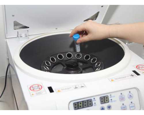 广西如何申请捐卵 广西壮族自治区人口和计划生育条例(2016年修正) ‘怀孕b超查