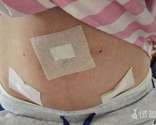 广西代怀基础检查 广西壮族自治区人口和计划生育条例(2016年修正) ‘32周双顶